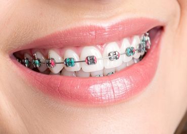 odontoclinicas mr en el meta