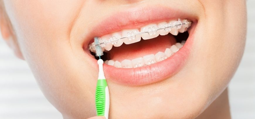 ortodoncia en villavicencio